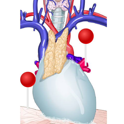 Detail Anatomie Lymphknoten Hals Nomer 12