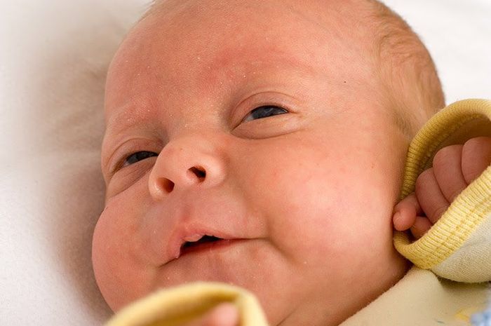 Detail Contoh Mata Cekung Pada Bayi Nomer 18