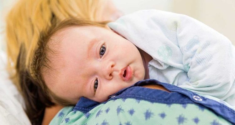 Detail Contoh Mata Cekung Pada Bayi Nomer 20