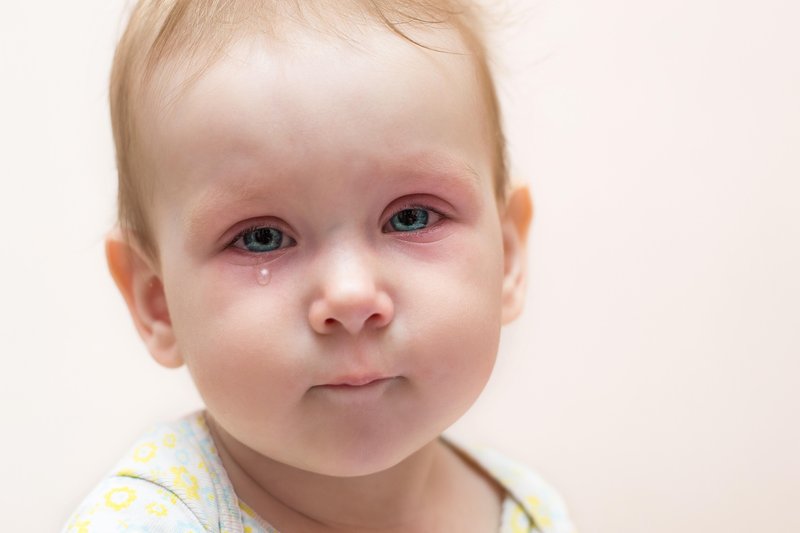 Detail Contoh Mata Cekung Pada Bayi Nomer 4