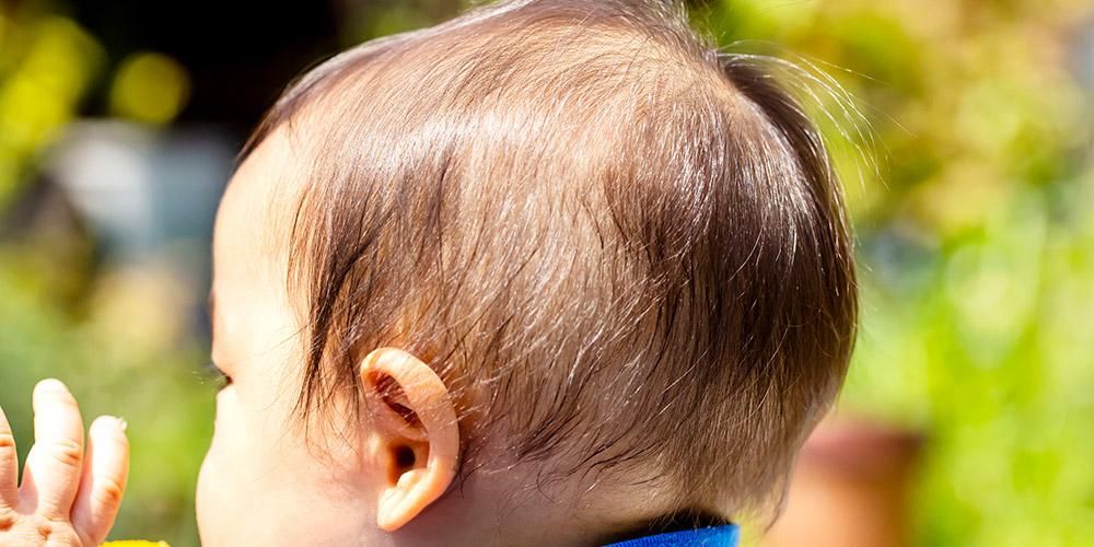 Detail Contoh Mata Cekung Pada Bayi Nomer 39