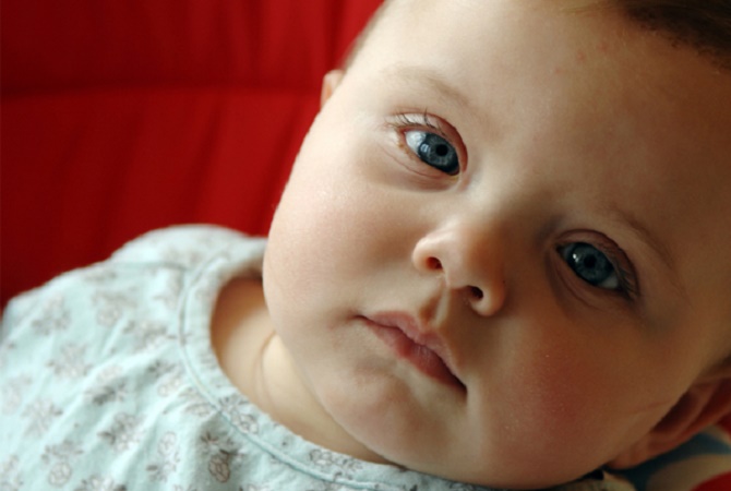 Detail Contoh Mata Cekung Pada Bayi Nomer 5