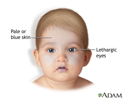 Detail Contoh Mengguncang Bayi Nomer 3