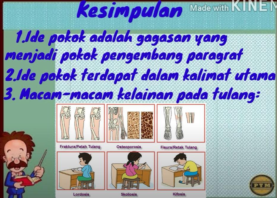 Detail Gambar Kartun Fisura Dan Fraktura Nomer 30