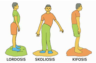 Detail Gambar Kartun Fisura Dan Fraktura Nomer 31