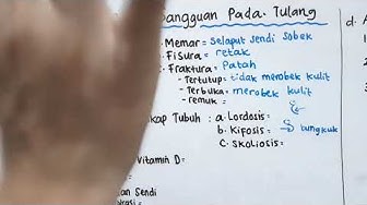 Detail Gambar Kartun Fisura Dan Fraktura Nomer 52