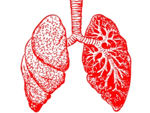 Detail Gambar Kartun Tuberculosis Nomer 43