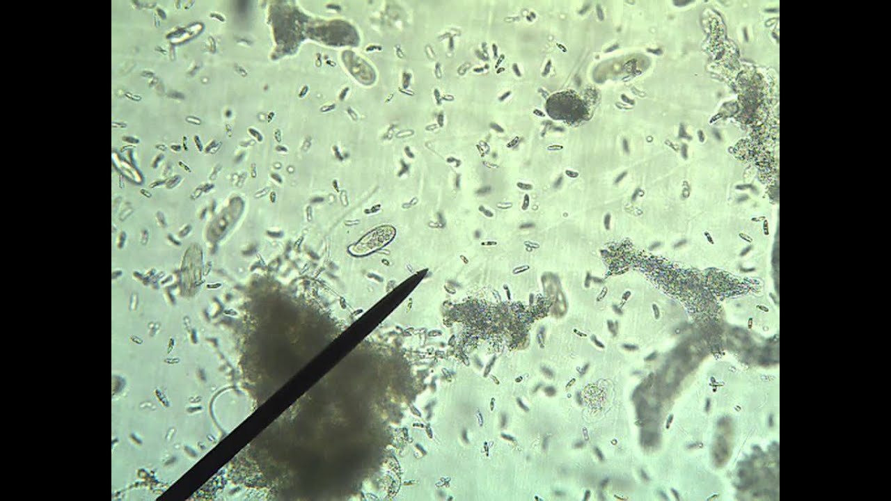 Detail Amoeba Dan Paramecium Nomer 17