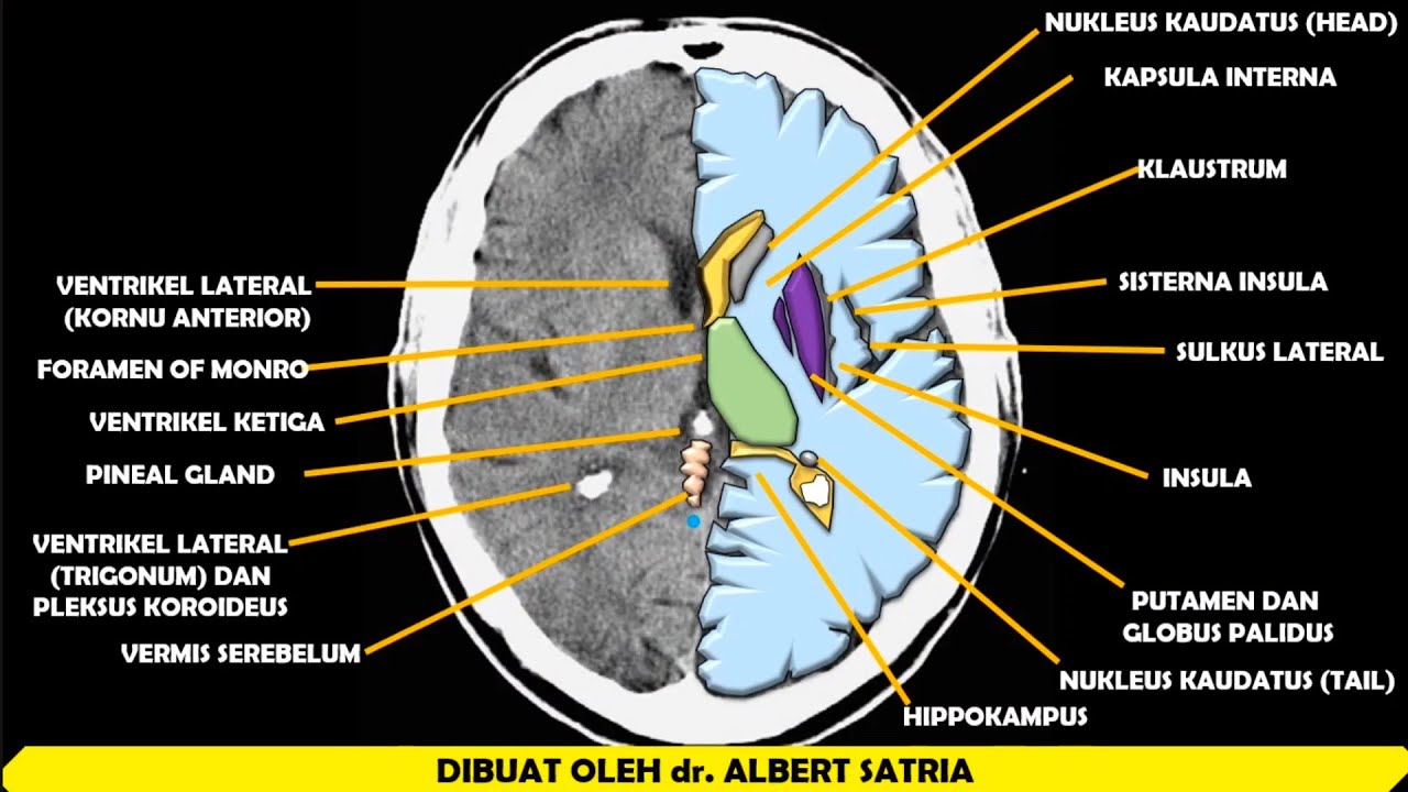 Detail Anatomi Kepala Dan Otak Nomer 52