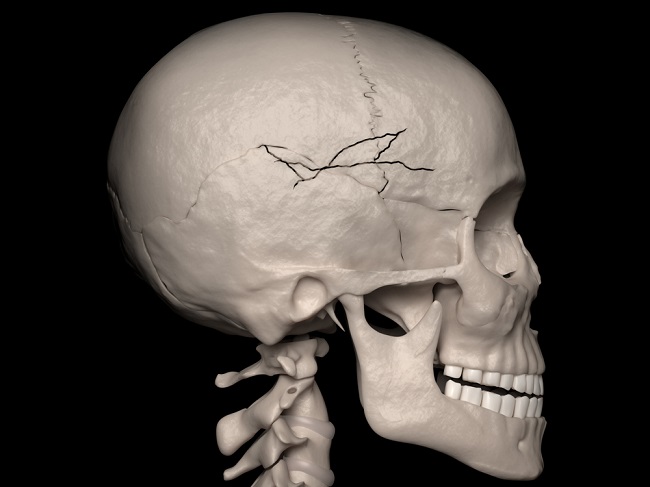 Detail Anatomi Tengkorak Kepala Nomer 3