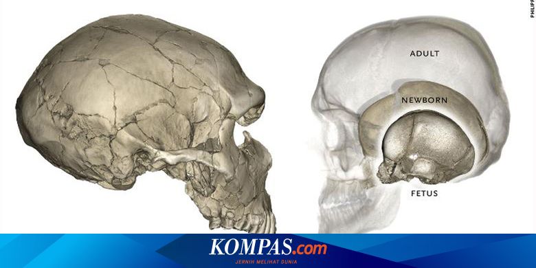 Detail Anatomi Tulang Kepala Nomer 19