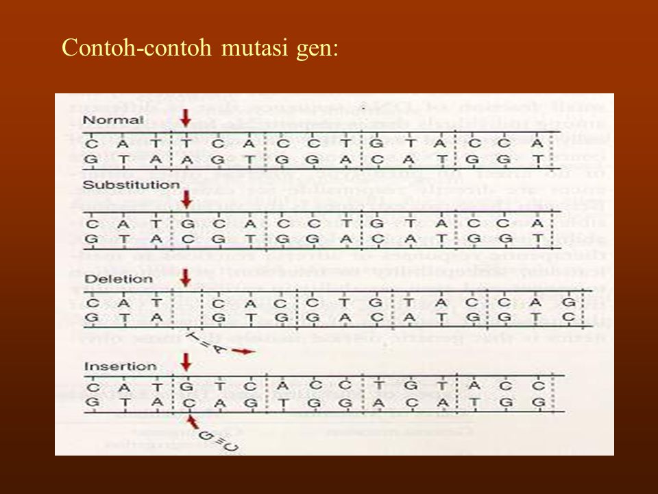 Detail Contoh Mutasi Gen Nomer 4