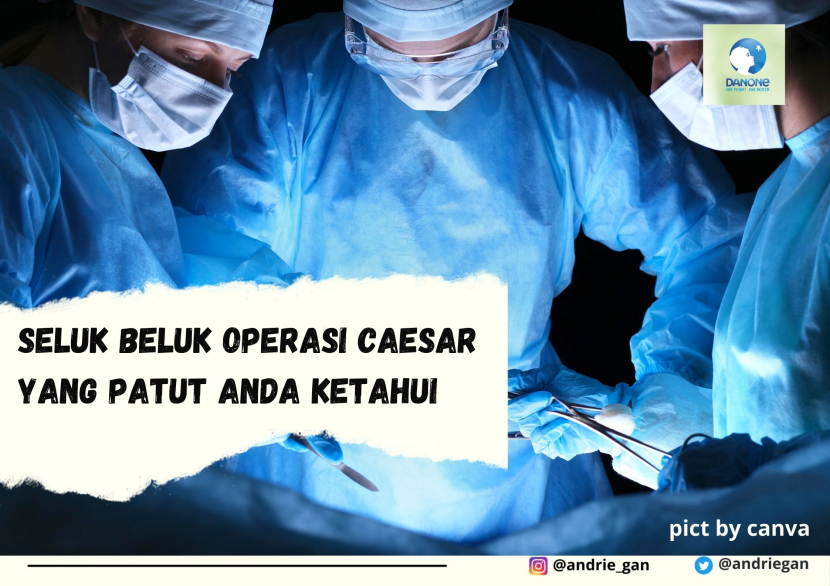 Detail Contoh Operasi Sesar Nomer 53