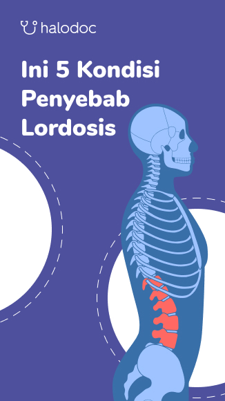 Detail Gambar Kelainan Lordosis Nomer 33