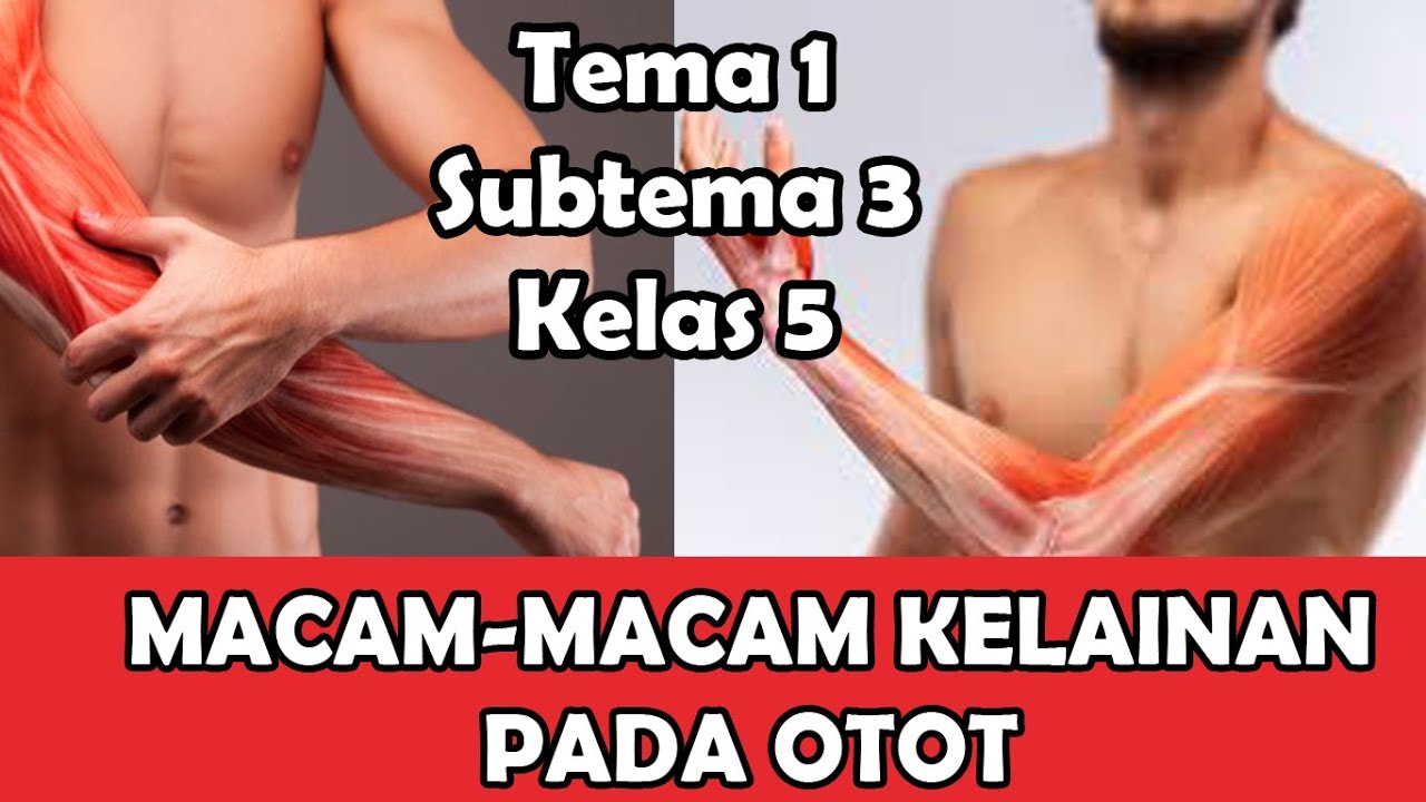 Detail Gambar Kelainan Otot Nomer 39