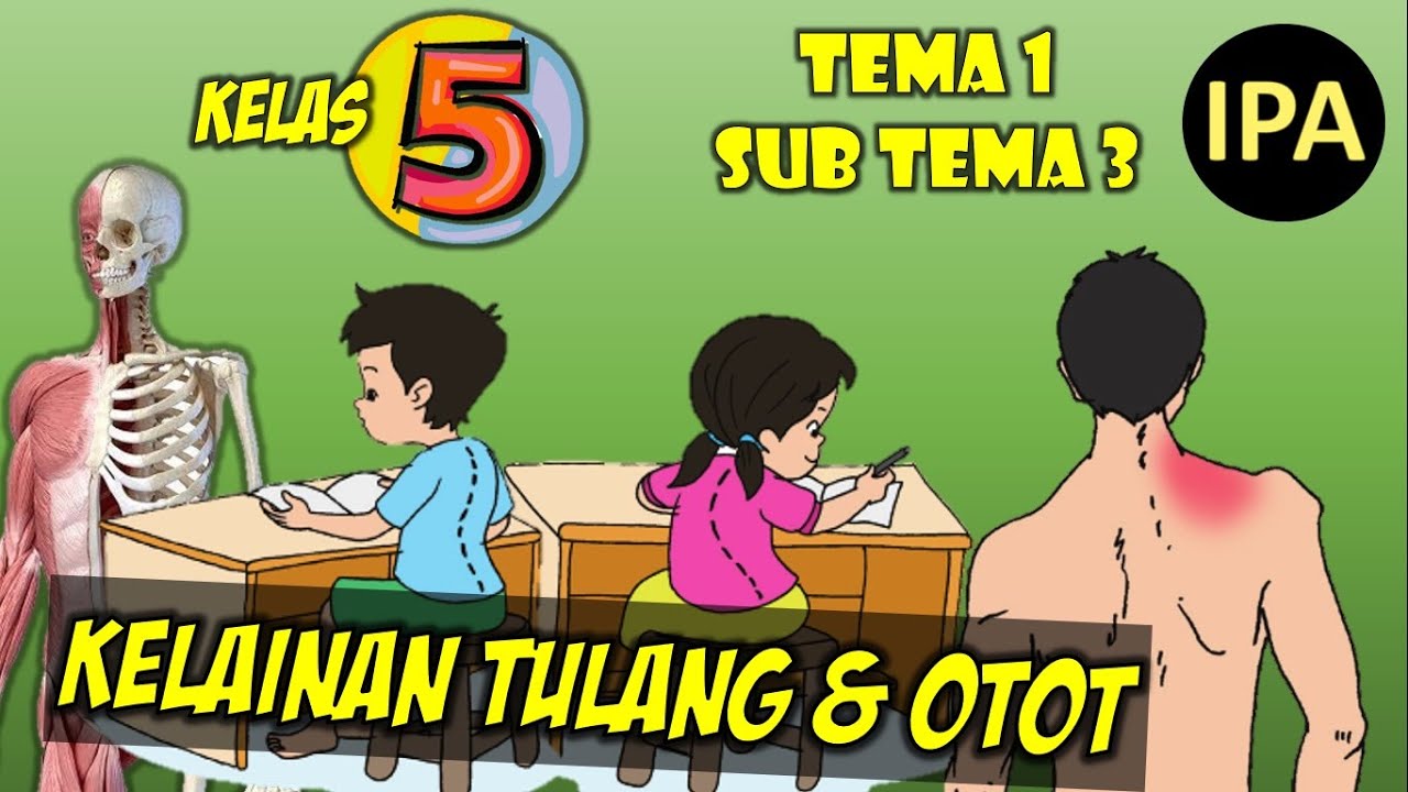 Detail Gambar Kelainan Pada Tulang Nomer 57