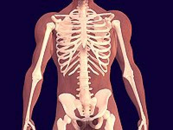 Detail Gambar Kelainan Tulang Osteoporosis Nomer 20