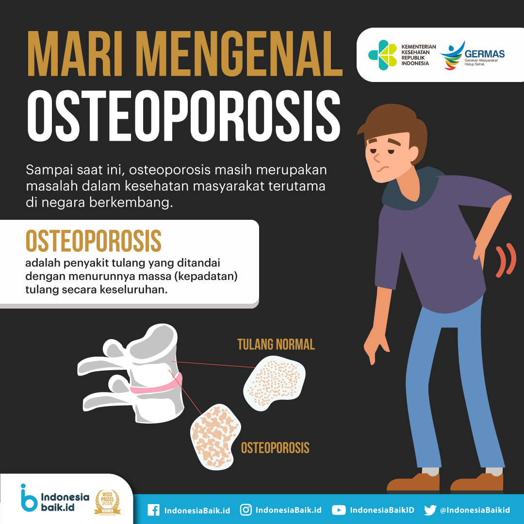 Detail Gambar Kelainan Tulang Osteoporosis Nomer 39