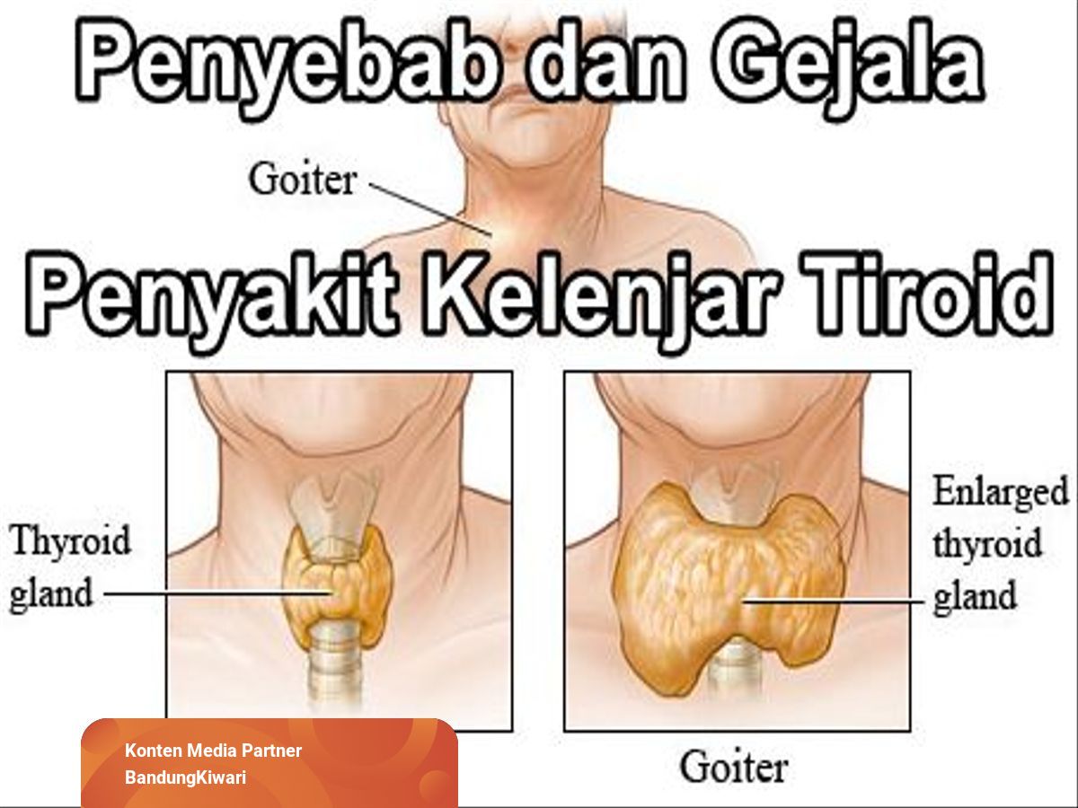 Detail Gambar Kelenjar Tiroid Nomer 8