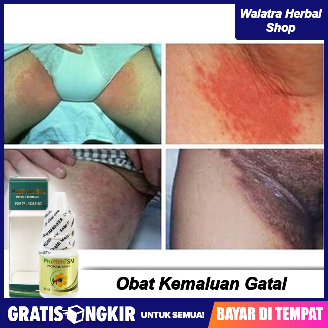 Detail Gambar Kemaluan Perempuan Nomer 45