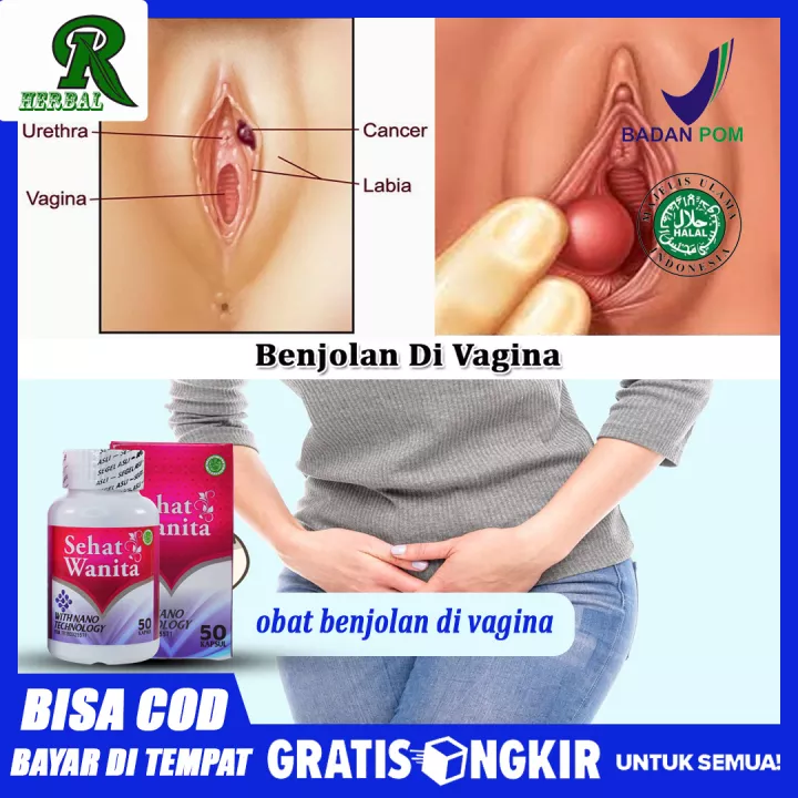 Detail Gambar Kemaluan Wanita Asli Nomer 8