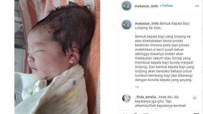 Detail Gambar Kepala Bayi Nomer 11