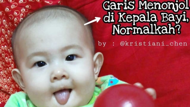 Detail Gambar Kepala Bayi Nomer 36