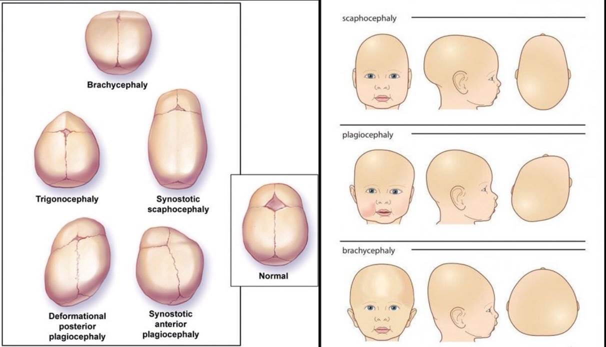 Detail Gambar Kepala Bayi Nomer 45