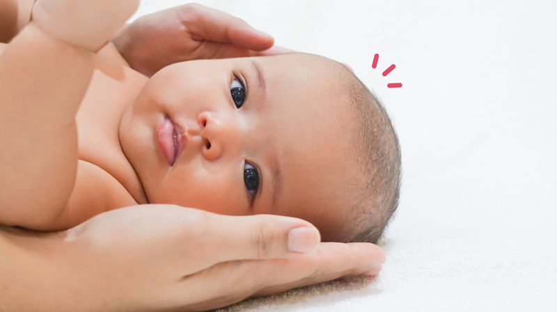 Detail Gambar Kepala Bayi Normal Nomer 10