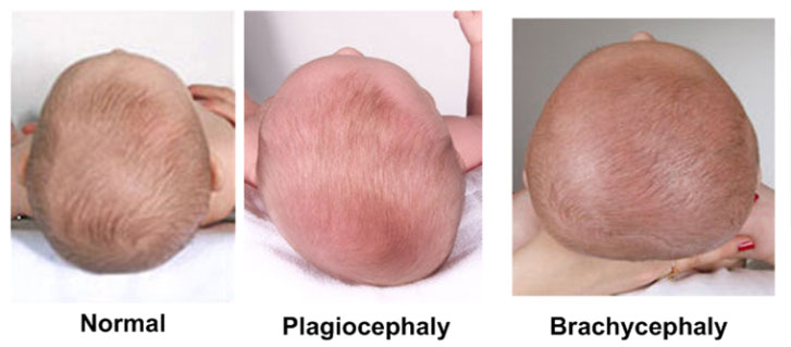 Detail Gambar Kepala Bayi Peyang Nomer 13