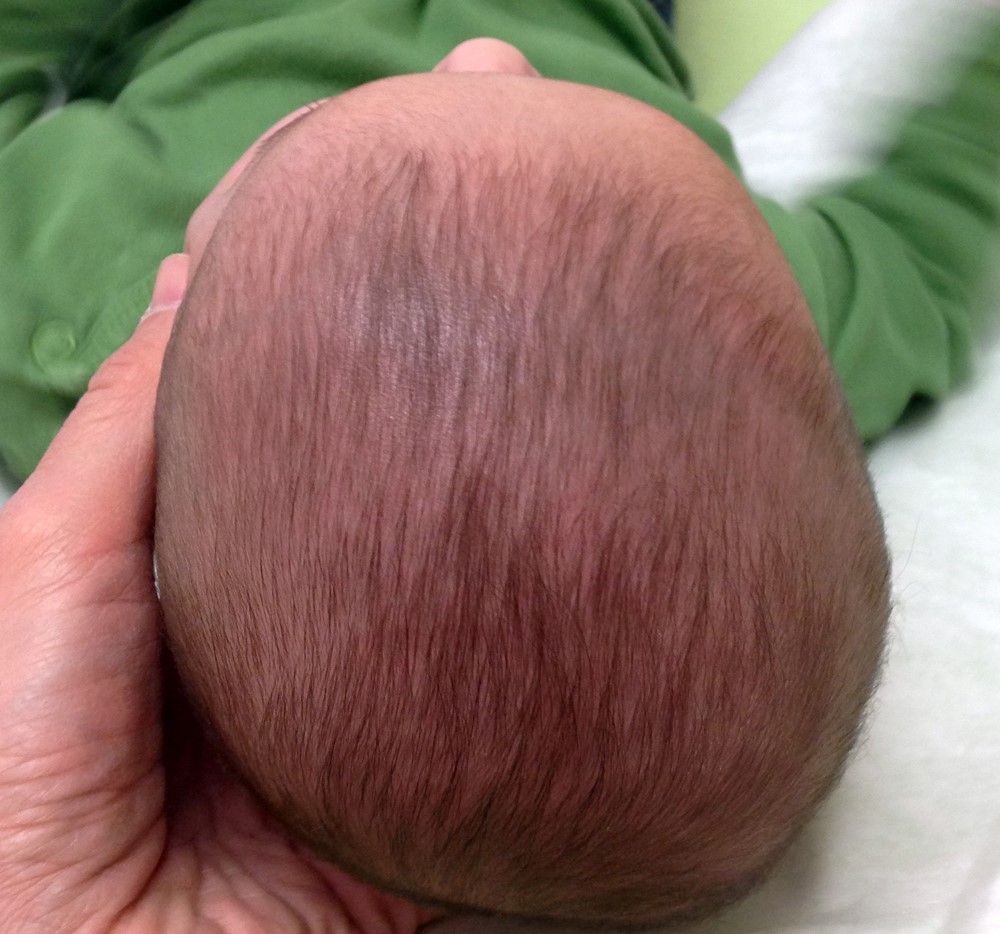Detail Gambar Kepala Bayi Peyang Nomer 27