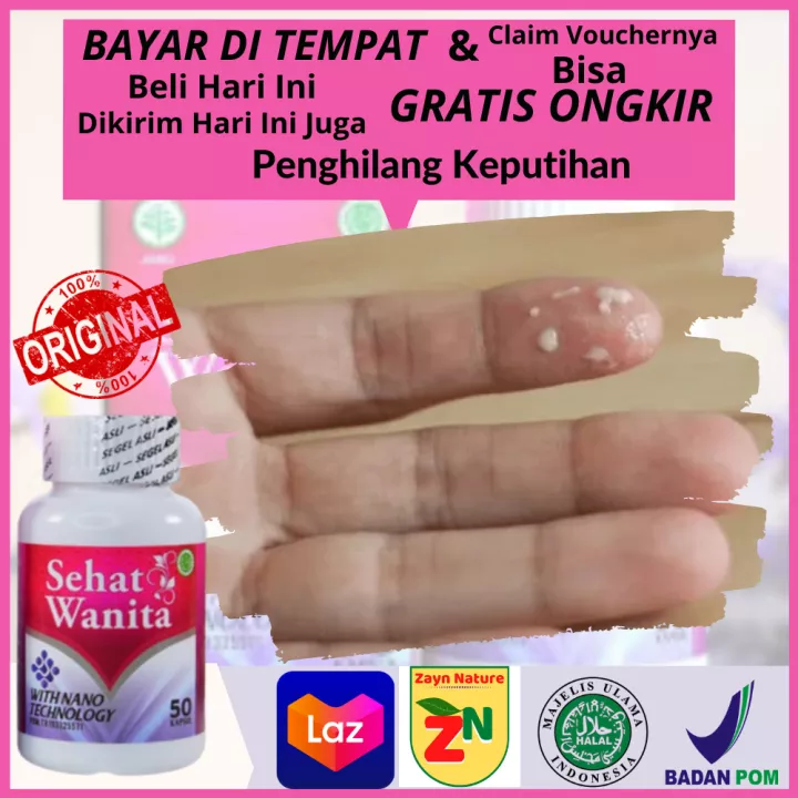 Detail Gambar Keputihan Abnormal Nomer 21