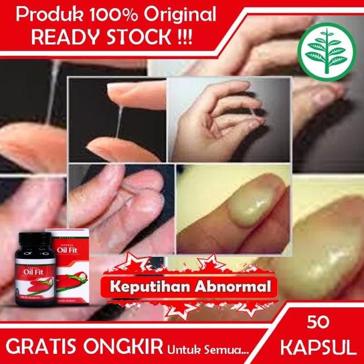 Detail Gambar Keputihan Abnormal Nomer 37
