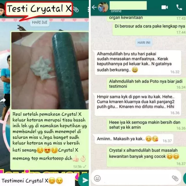 Detail Gambar Kerak Keputihan Nomer 15