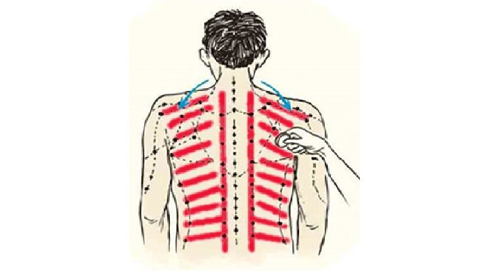Detail Gambar Kerokan Badan Nomer 20