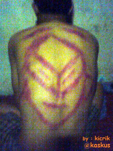 Detail Gambar Kerokan Badan Nomer 24