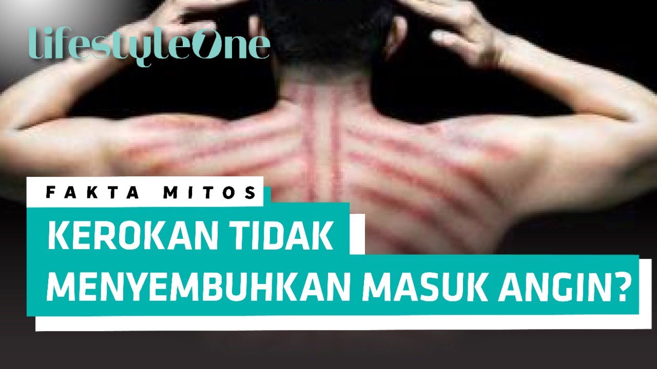 Detail Gambar Kerokan Badan Nomer 35