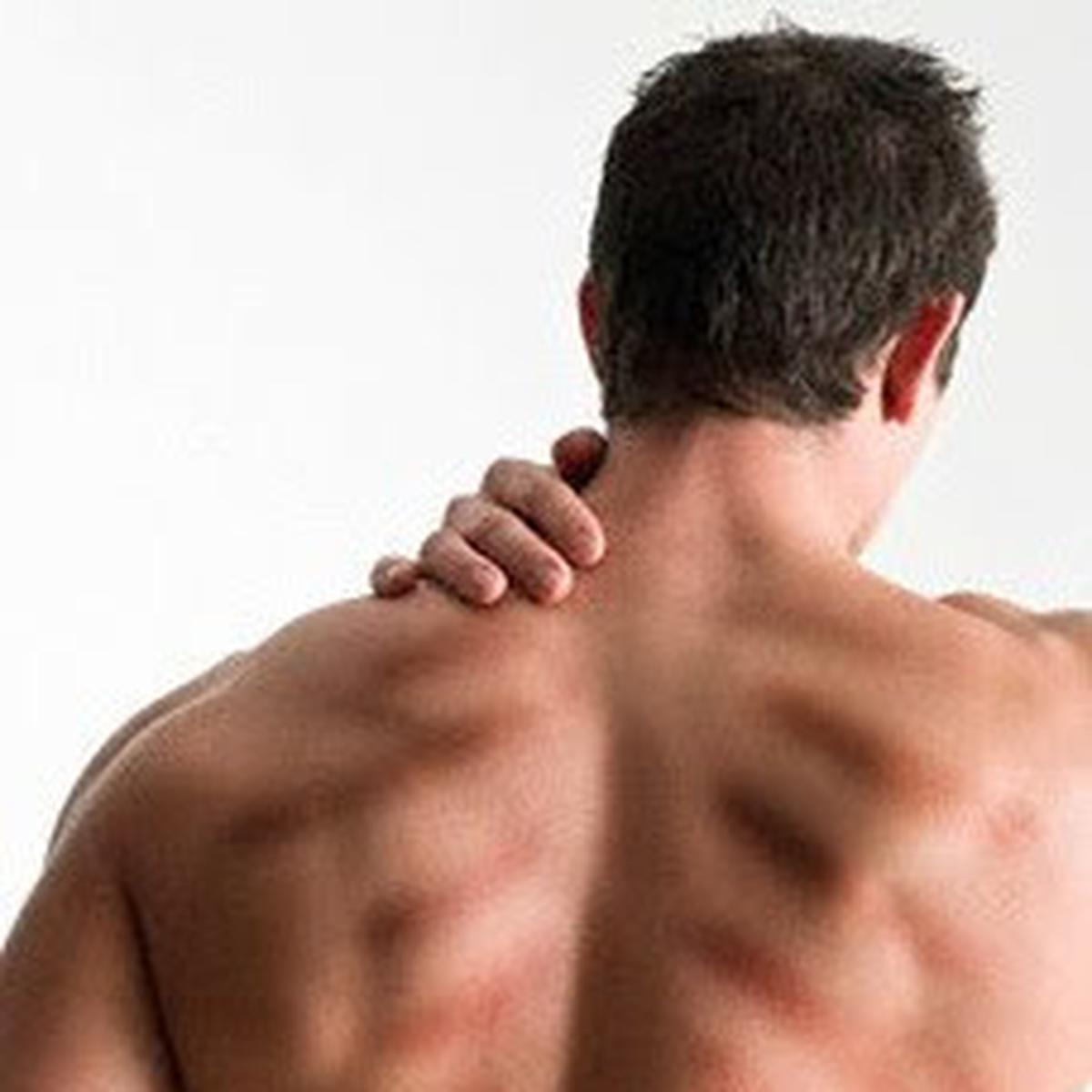 Detail Gambar Kerokan Badan Nomer 36