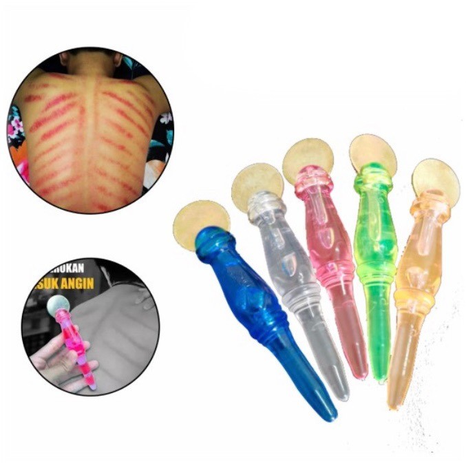 Detail Gambar Kerokan Badan Nomer 48
