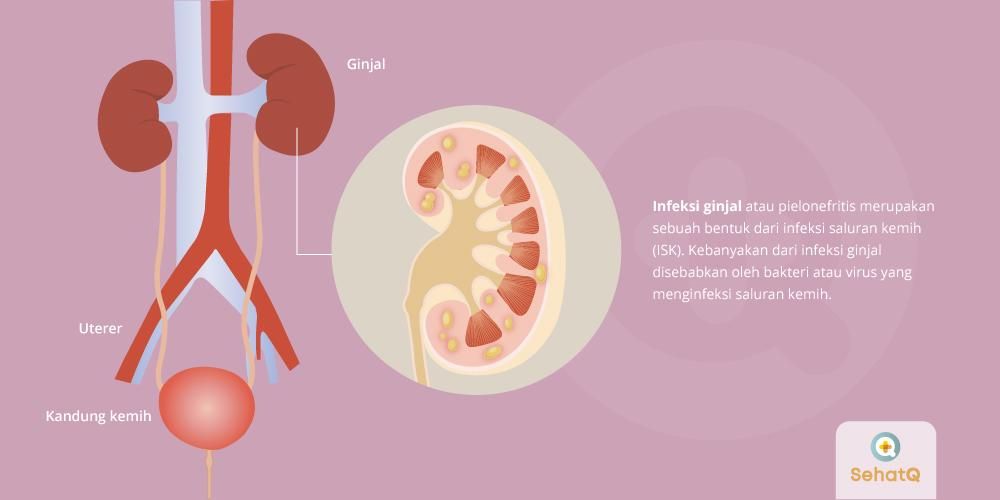 Detail Gambar Kesembuhan Dari Suatu Penyakit Orang Yang Mengalami Sakit Ginjal Nomer 37