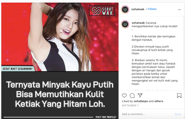 Detail Gambar Ketiak Putih Nomer 38