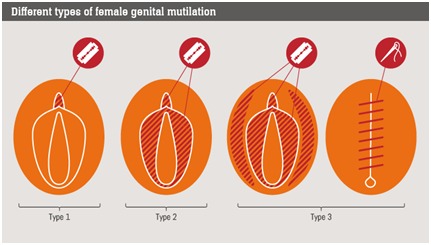 Detail Gambar Khitan Wanita Nomer 2