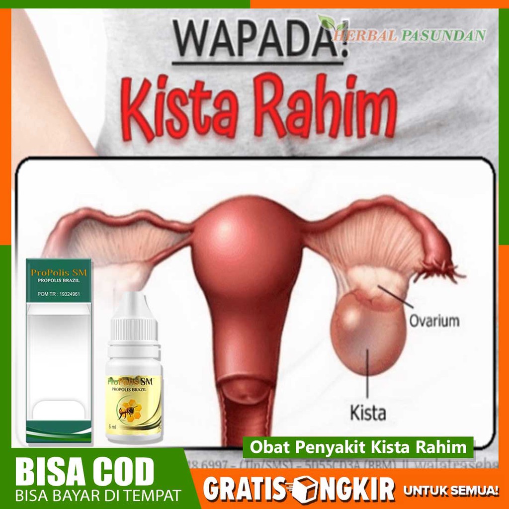 Detail Gambar Kista Bartholin Nomer 29