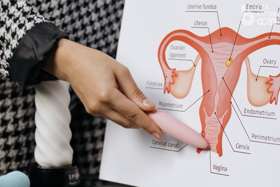 Detail Gambar Kista Bartholin Nomer 6