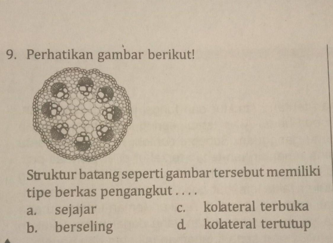 Detail Gambar Kolateral Terbuka Dan Tertutup Nomer 21