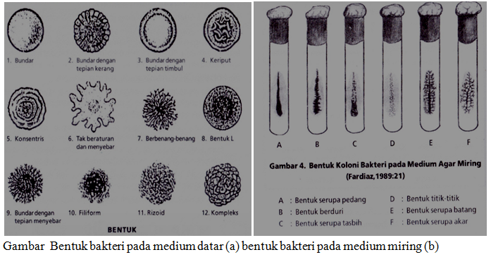 Detail Gambar Koloni Bakteri Nomer 13