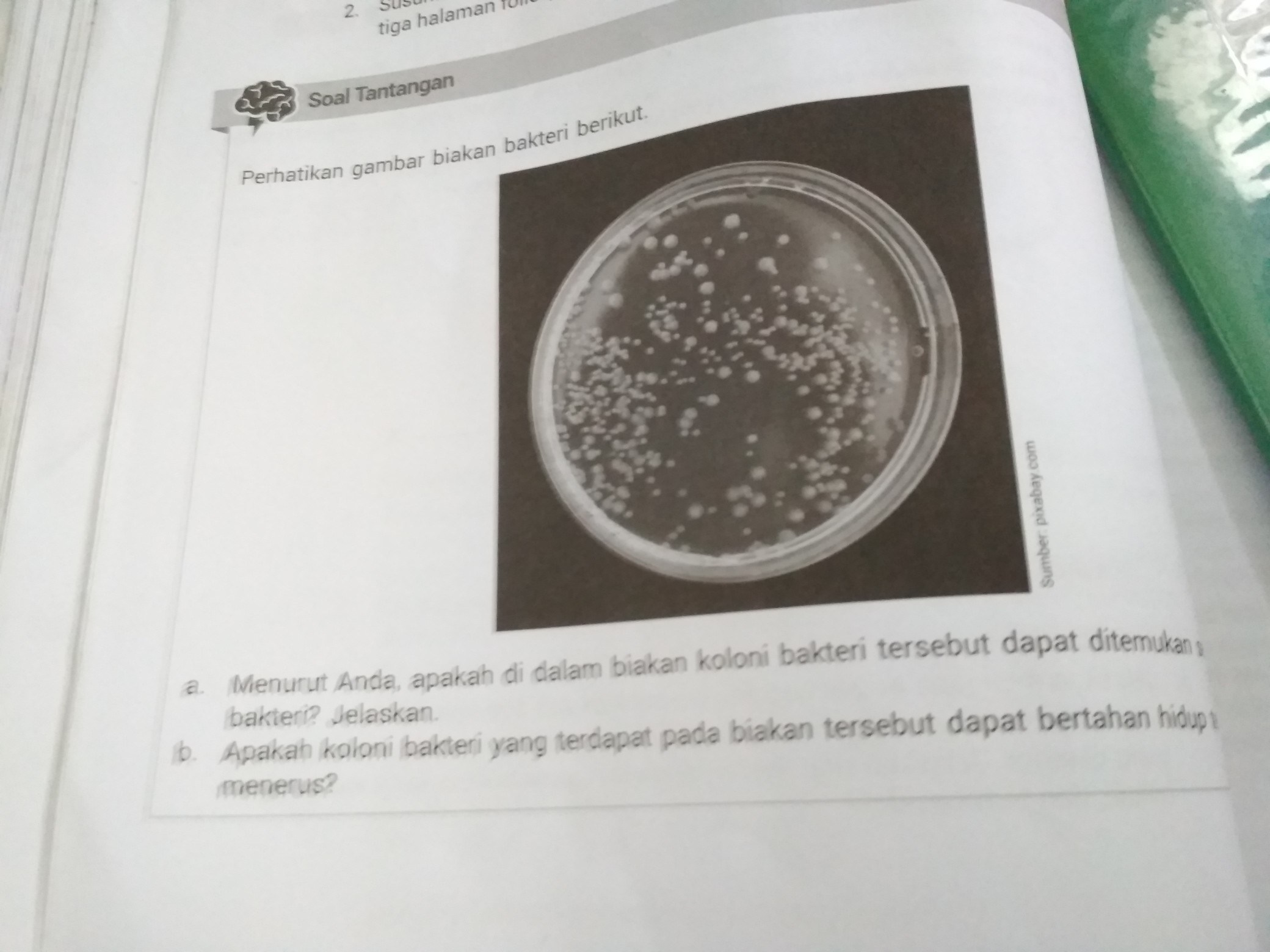 Detail Gambar Koloni Bakteri Nomer 43