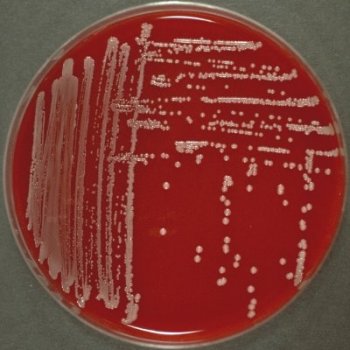 Detail Gambar Koloni Pada Agar Darah Nomer 18