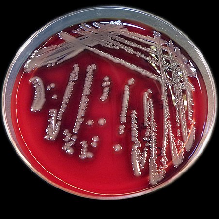 Detail Gambar Koloni Pada Agar Darah Nomer 22