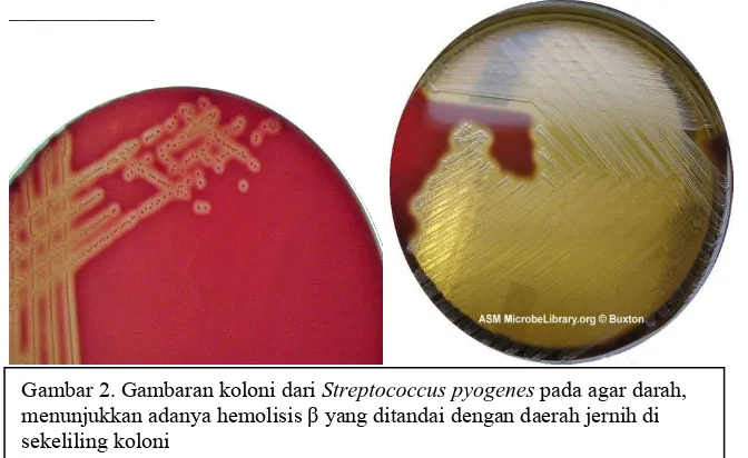 Detail Gambar Koloni Pada Agar Darah Nomer 23